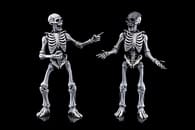Mythic Legions GRAVEYARD SKELETONS 4パック Graveyard Skeletons - Special projects action figure from Four