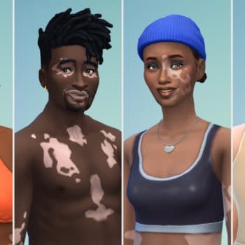 The Sims 4 Introduces Vitiligo Skin Feature For Characters