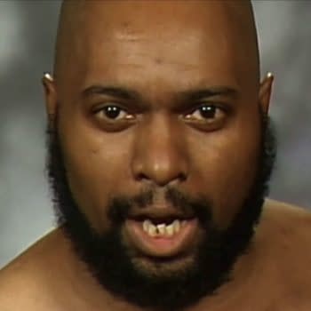 A close-up of a bald man with a beard, showing an intense expression. He has noticeable missing teeth and is dressed casually, against a blurred background.