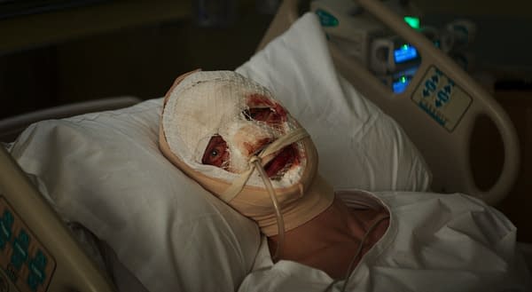 A hospitalized figure lies on a bed, with their face heavily bandaged and bloodied, conveying a sense of distress. The scene suggests a medical or recovery context, related to the theme of 'Clayface.'