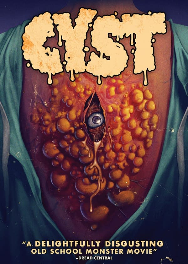 Giveaway: Win A DVD Copy Of The Horror Film Cyst